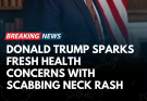 Donald Trump’s Visible Neck Rash Prompts Renewed Health Scrutiny